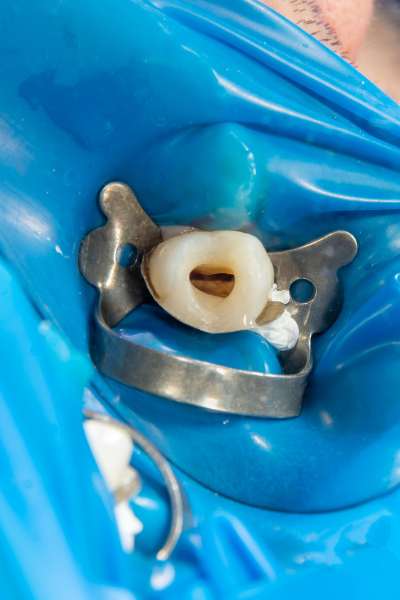 PERIODONCIA