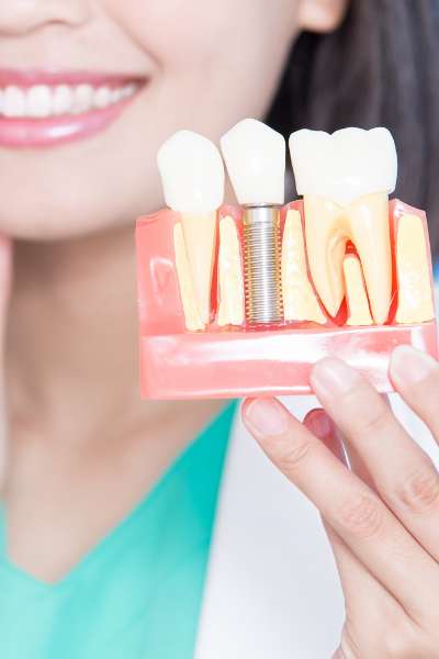 PRÓTESIS DENTALES